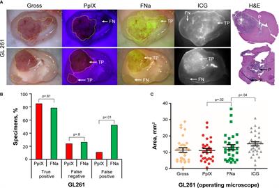 5-aminolevulinic acid, fluorescein sodium, and indocyanine green for glioma margin detection: analysis of operating wide-field and confocal microscopy in glioma models of various grades